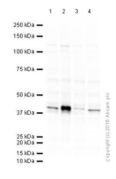 Anti-Aurora B antibody(AB2254)