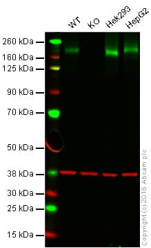 Anti-Niemann Pick C1 antibody [EPR5209] - BSA and Azide free(AB224268)