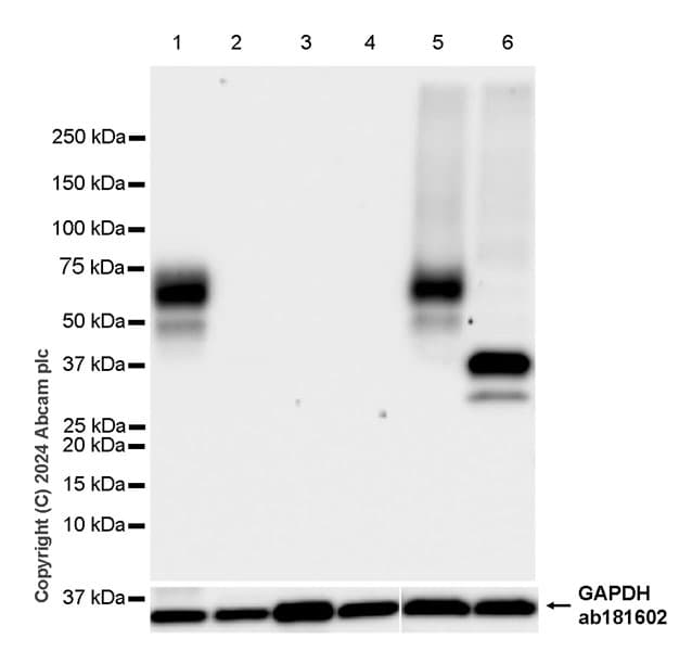 Lox 1 Antibody Epr27871 67 Bsa And Azide Free Ab317690  Western Blot Img432058