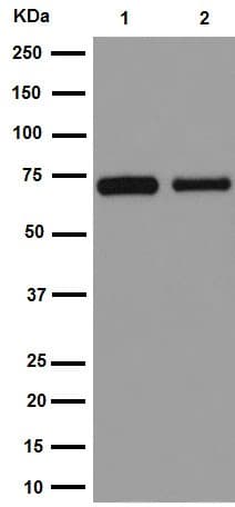 Anti-Choline Acetyltransferase antibody [EPR16590](AB178850)