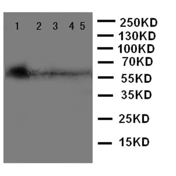 Mbd4 Med1 Antibody C Terminal Ab191037  Western Blot Img73317