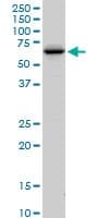 Fem1a Antibody Ab103421  Western Blot Img156055