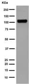 Psma Antibody Epr6253 Ab133579  Western Blot Img95073