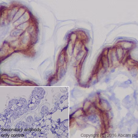 Trop2 Antibody Epr20043 Ab214488 Immunohistochemistry Formalin Pfa Fixed Paraffin Embedded Sections Img136000