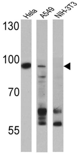 Anti-Dnmt3b antibody(AB2851)