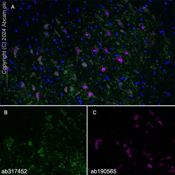 Anti-VAChT antibody [EPR29154-71](AB317452)