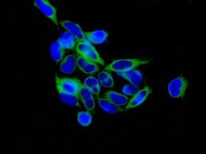 Tacc3 Antibody Epr7756 Bsa And Azide Free Ab224525  Immunocytochemistry Immunofluorescence Img124253