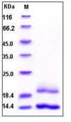 Recombinant Human CST6 protein (His tag)(AB276268)