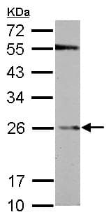 Anti-GST3 / GST pi antibody(AB153949)
