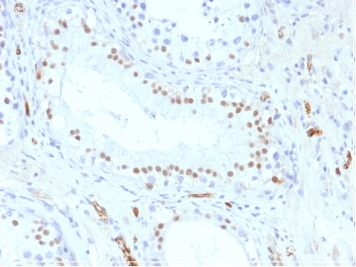 Anti-Wilms Tumor Protein antibody [WT1/857](AB220212)
