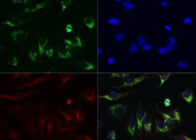 Anti-LC3B antibody(ab51520)