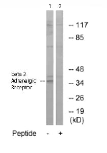 Anti-beta 3 Adrenergic Receptor antibody(AB76249)