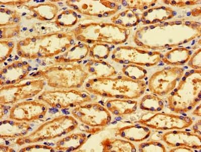 Anti-TTC11/FIS1 antibody(ab229969)