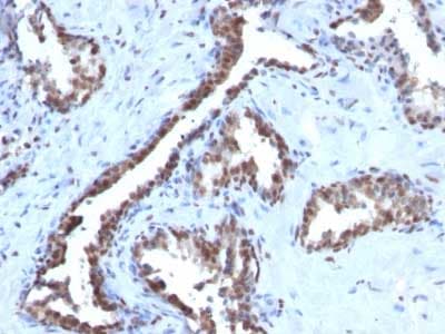 Cyclin B1 Antibody Ccnb1 1098 Ab212977  Immunohistochemistry Formalin Pfa Fixed Paraffin Embedded Sections Img124963