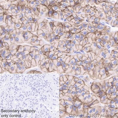 Anti-EpCAM antibody [EPR20532-225](AB223582)
