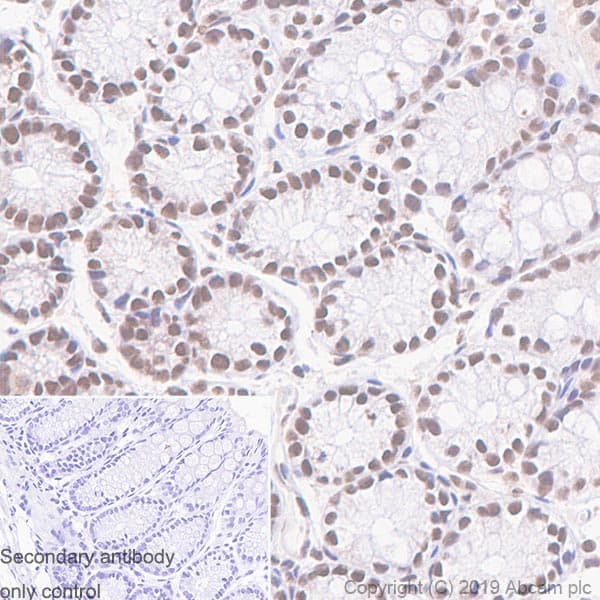 Smarcd2 Antibody Epr20860 251 Ab220164  Immunohistochemistry Formalin Pfa Fixed Paraffin Embedded Sections Img104327