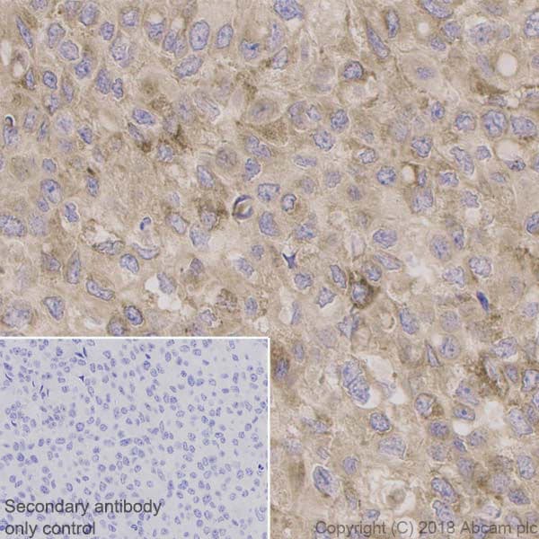 Bdnf Antibody Epr1292 Ab108319 Immunohistochemistry Formalin Pfa Fixed Paraffin Embedded Sections Img128759