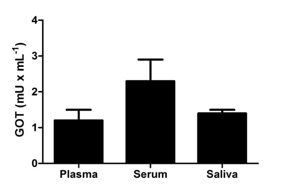 Aspartate Aminotransferase Activity Assay Kit(AB105135)