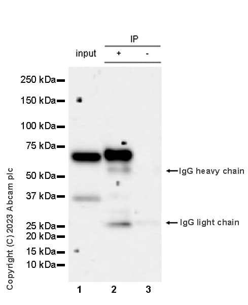 Mouse IgG1, kappa monoclonal [MOPC-21] - isotype control(AB18443)