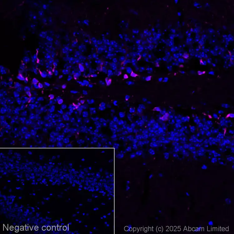 Goat Anti-Rabbit IgG H&L (Alexa Fluor® 594)(AB150080)