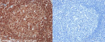 Anti-CD45 antibody(AB10558)