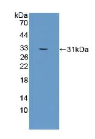 Anti-Kallikrein 2/KLK2 antibody(ab232980)