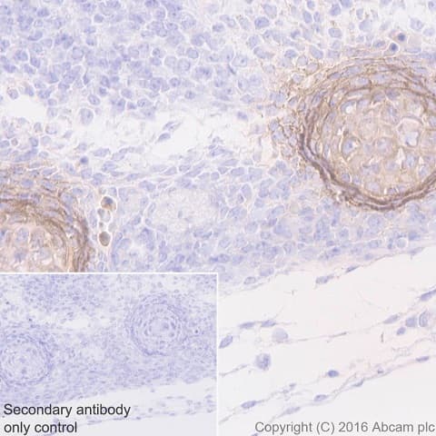 Anti-Tenascin C antibody [EPR4219](AB108930)