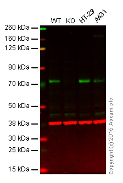 Anti-PKC zeta antibody [EP1490(2)](AB108970)