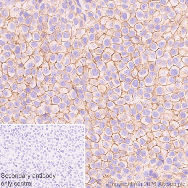Anti-Claudin 1 antibody [RM1186](AB317709)