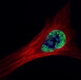 Ets2 Antibody Ab272866  Immunocytochemistry Immunofluorescence Img28232