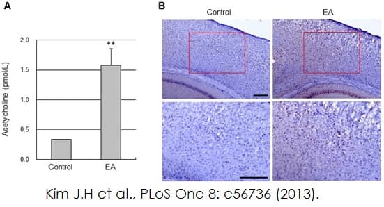 Choline/Acetylcholine Assay Kit(AB65345)