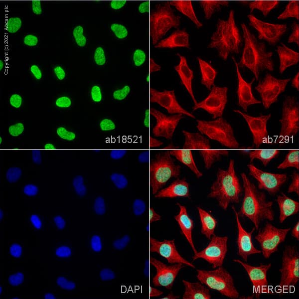 Anti-Histone H3 antibody(AB18521)