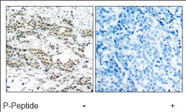 Anti-FOXO4/AFX (phospho S197) antibody(AB47278)
