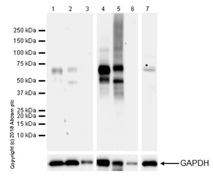 Anti-2N Tau antibody [EPR21723](ab218316)