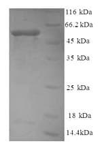 Recombinant Human non-muscle Myosin IIA protein (Tagged)(ab226278)
