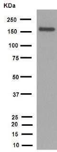 Anti-MSH6 antibody [EPR3945](AB92471)