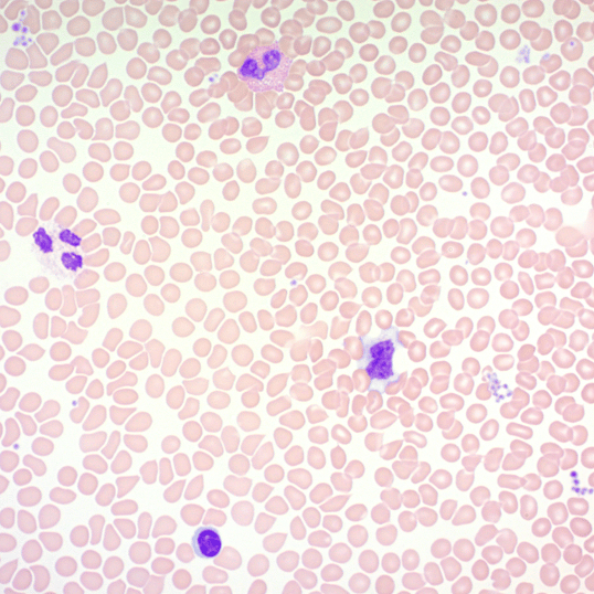 Wright-Giemsa Stain Kit(AB245888)