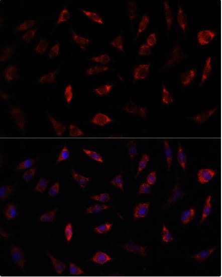 Anti-Frataxin antibody(AB175402)