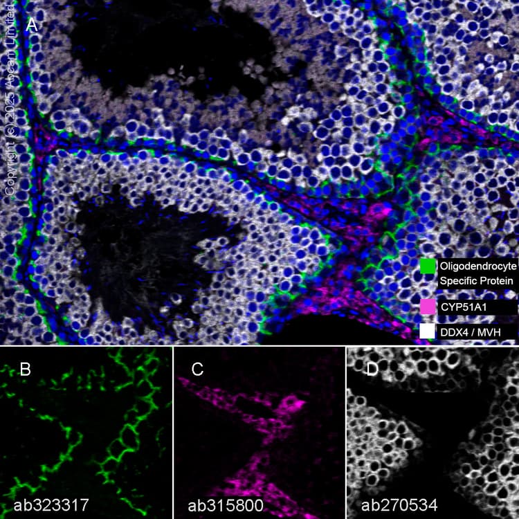Anti-DDX4 / MVH antibody [EPR24148-58](AB270534)