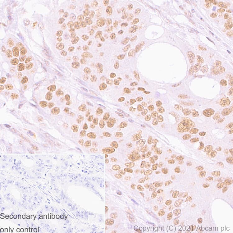 Anti-PMS2 antibody [EPR3947](AB110638)