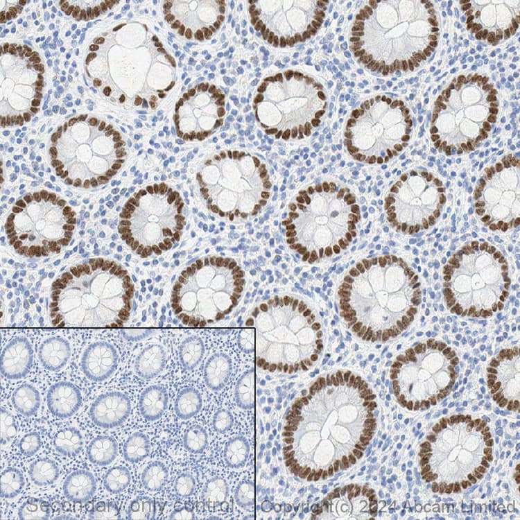 Anti-SATB2 antibody [EPNCIR130A] - BSA and Azide free(AB212177)
