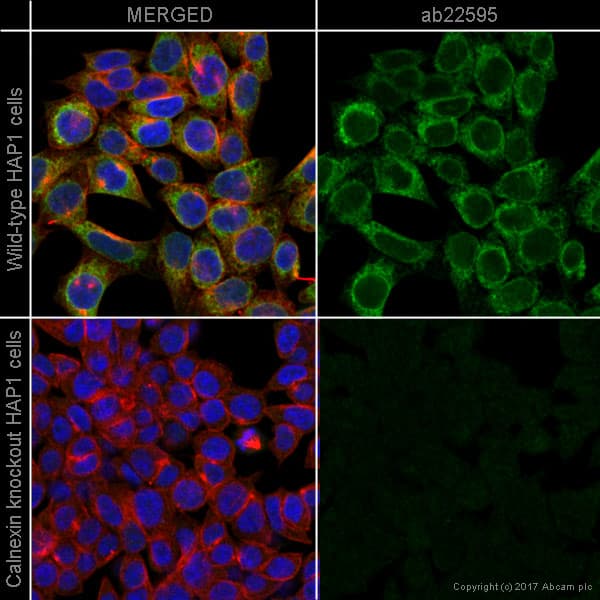 Anti-Calnexin antibody - ER Marker(AB22595)