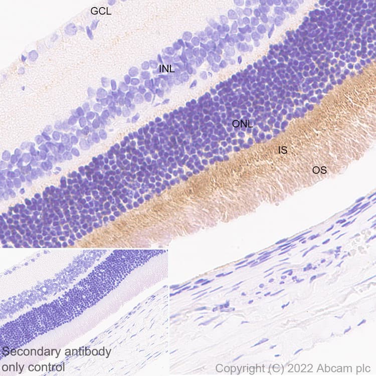 Anti-ABCA4 antibody [EPR26543-66](AB303504)