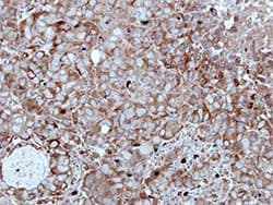 Hippi Ift57 Antibody Ab154601  Immunohistochemistry Formalin Pfa Fixed Paraffin Embedded Sections Img118961