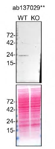Anti-RAB7 antibody [EPR7589](AB137029)