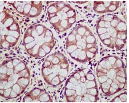 Ceacam6 Antibody Epr4403 Bsa And Azide Free Ab235139  Immunohistochemistry Formalin Pfa Fixed Paraffin Embedded Sections Img110124