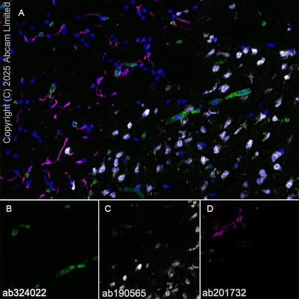 Alexa Fluor® 647 Anti-NeuN antibody [EPR12763] - Neuronal Marker(AB190565)