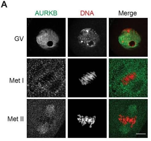 Anti-Aurora B antibody(AB2254)