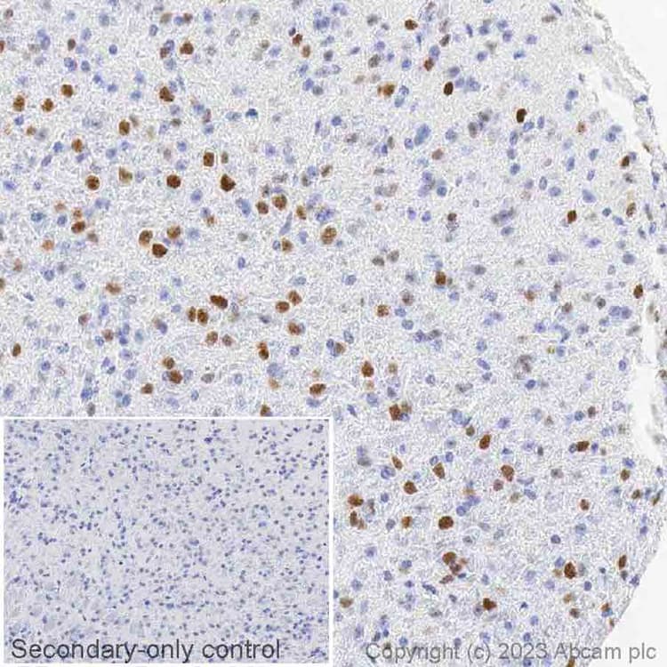Anti-Ctip2 antibody [EPR23120-25](AB240636)