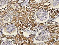 Anti-CXCL14 antibody(AB137541)